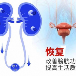 膀胱炎有哪些癥狀 男性如何預防膀胱炎發病