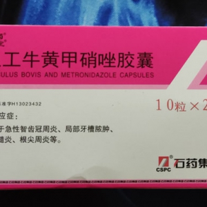 牙齦腫痛怎么辦 牙疼消炎用什么藥最有效